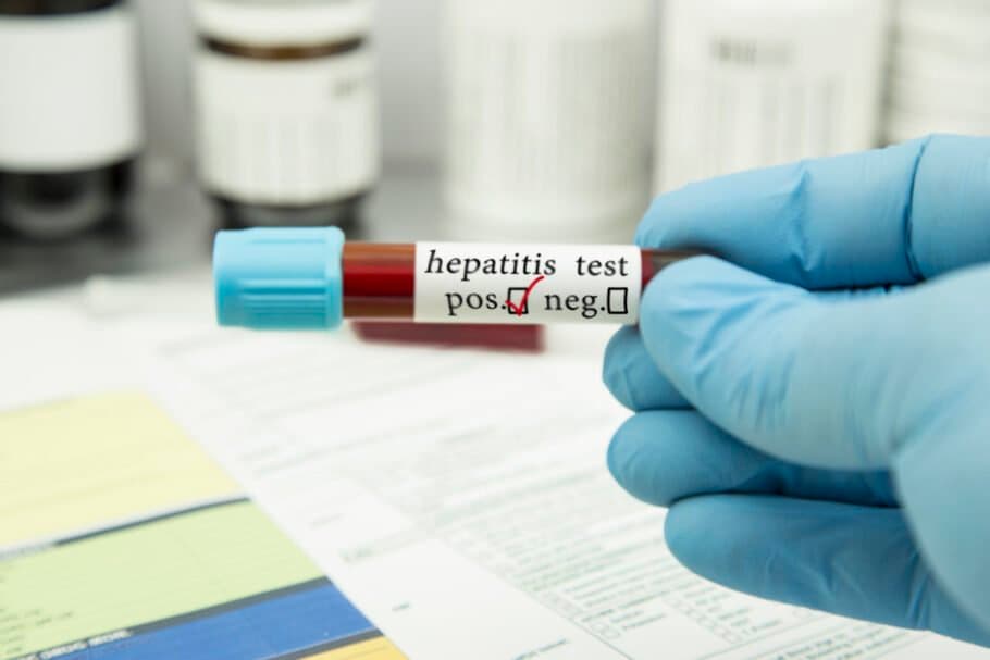 Surto de hepatite aguda grave de origem desconhecida coloca Brasil em alerta