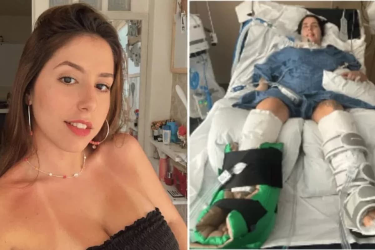 Brasileira fala sobre recuperação depois de ficar paralisada ao tomar sopa nos EUA: “Foi só uma colher”
