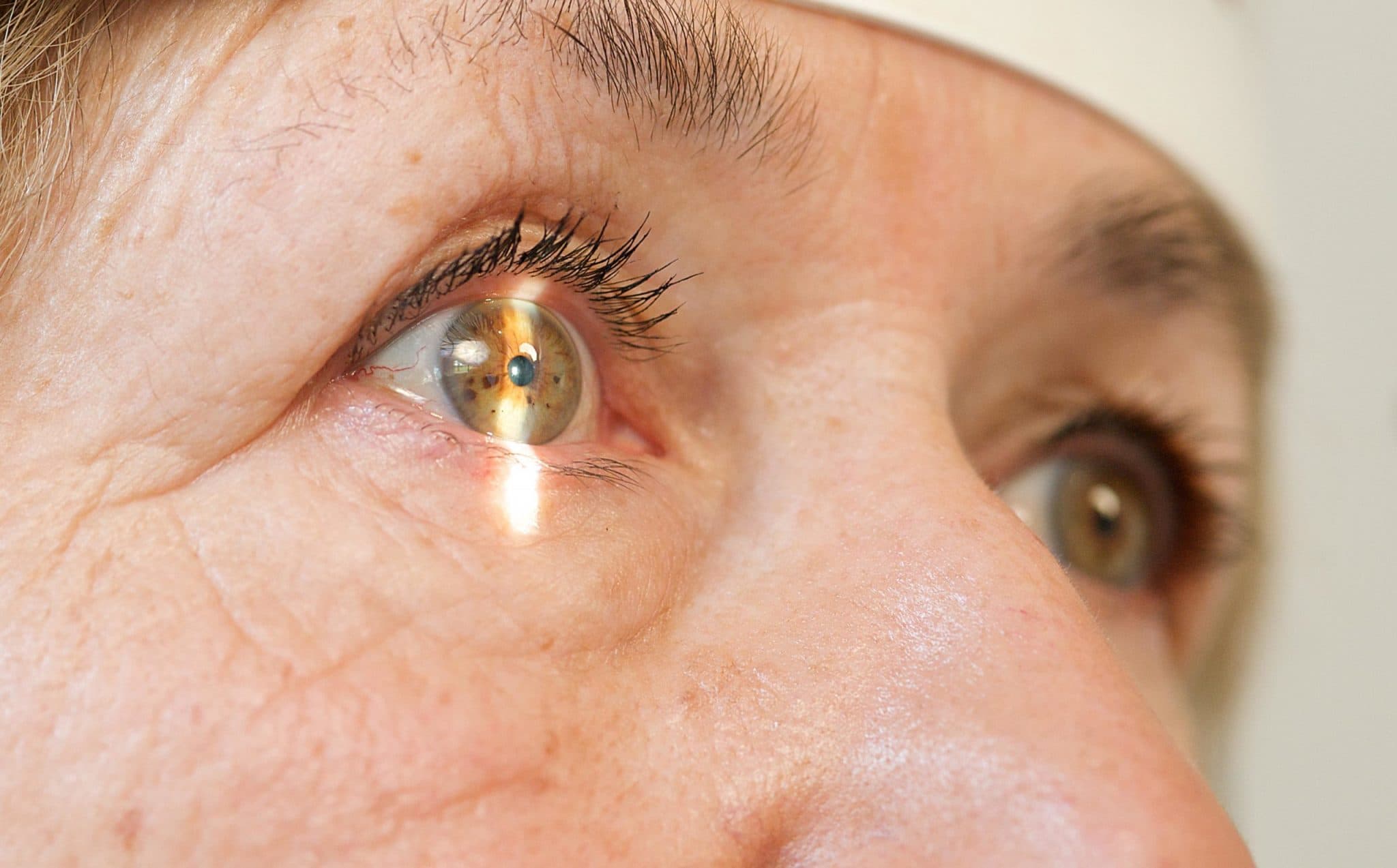 Campanha de Conscientização do Glaucoma avança na Câmara de Manaus