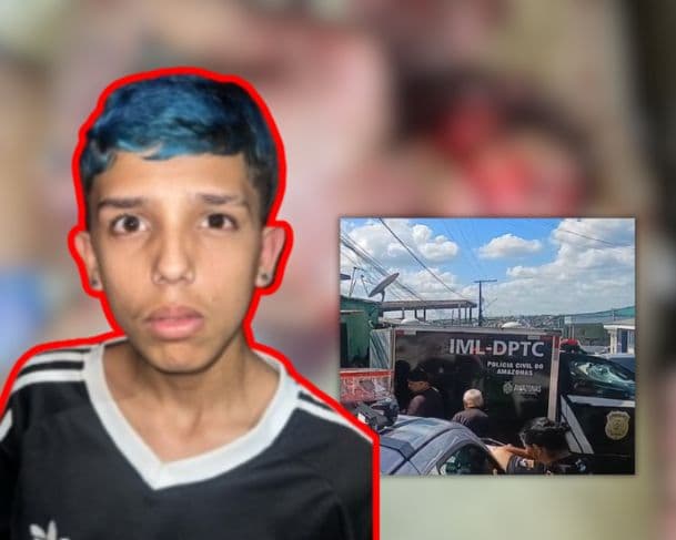 Veja como ficou “Parazinho” após ser metralhado por criminosos em Manaus