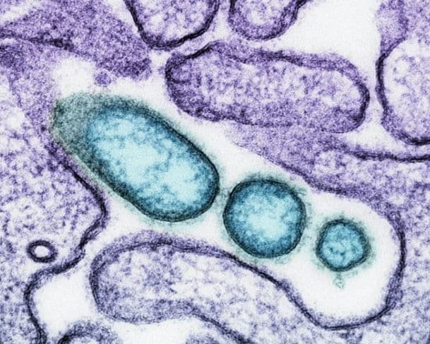 Aquecimento global pode favorecer avanço de amebas perigosas, alerta estudo