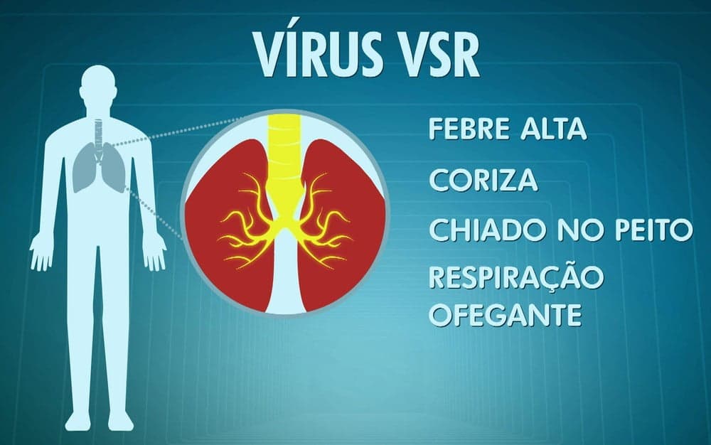Aumento de Vírus Sincicial no Amazonas