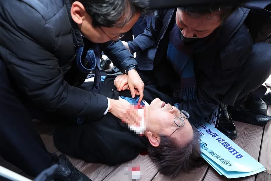 “Cortou cerca de 60% de sua veia jugular”, afirma médico que fez cirurgia em líder coreano atacado com faca