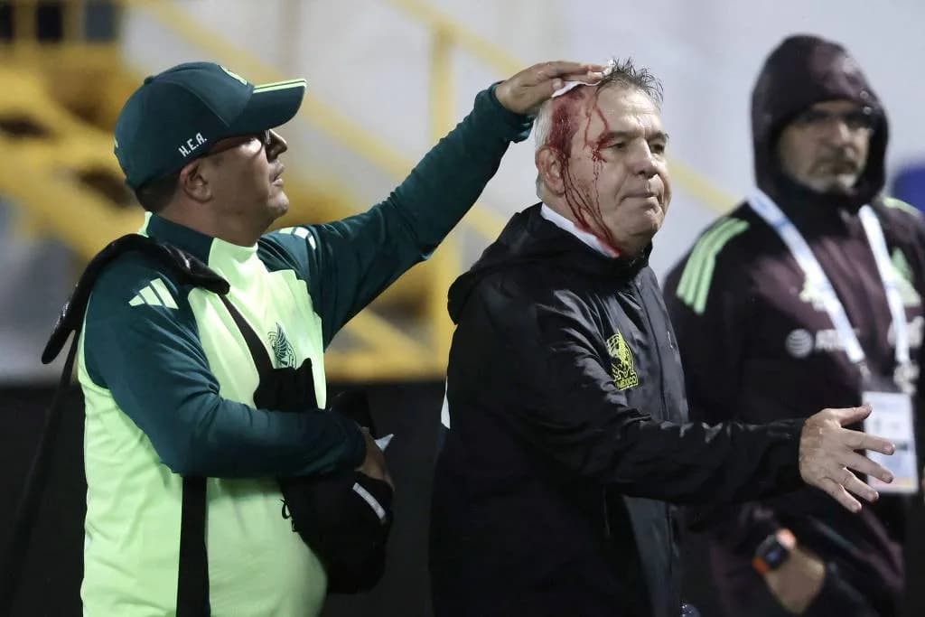 VÍDEO: Técnico do México é ferido após derrota e sai de campo com cabeça sangrando