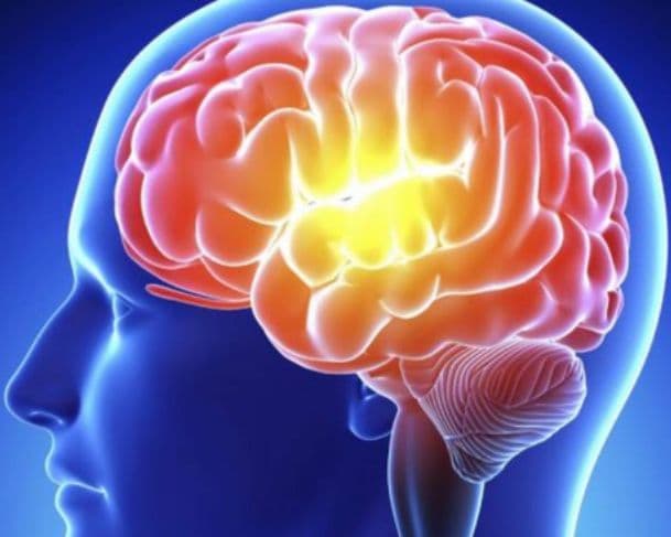 Neurocirurgião aponta as bebidas que mais aumentam o risco de AVC