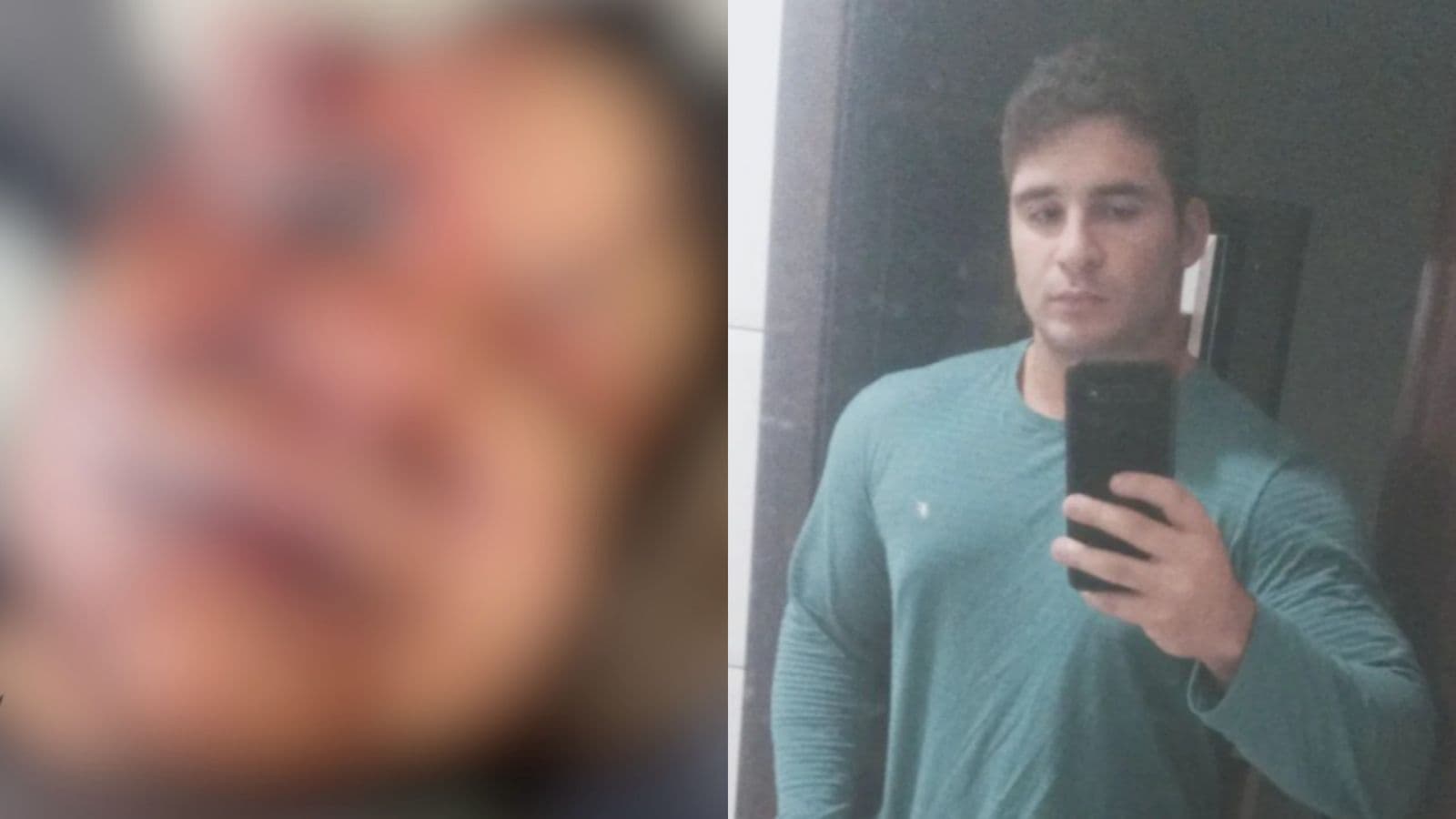 “Os ossos da minha face estão quebrados”, diz mulher agredida com 61 socos em elevador de condomínio