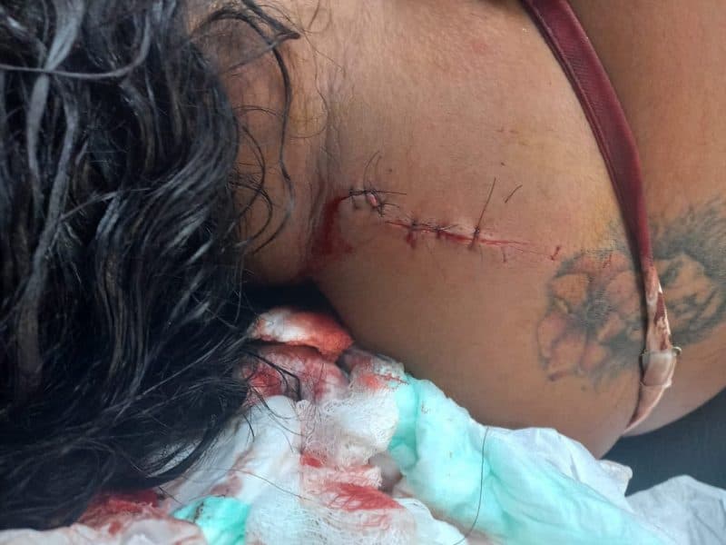 Homem é suspeito de tentar matar a esposa com gargalo de garrafa em Manaus